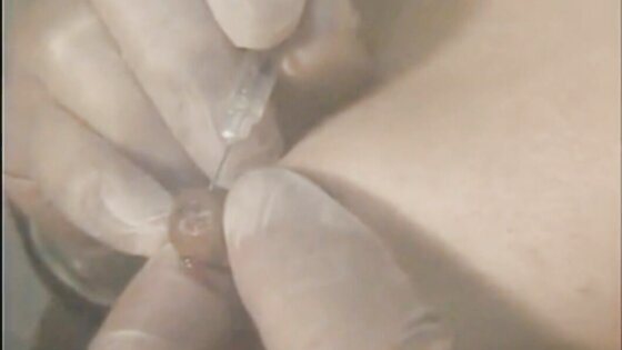 BDSM nipple play with needles from Japan