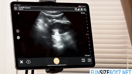 My black twink patient wants my dick inside his ass