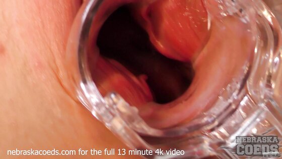 Becky Berry Gyno Exam with Speculum & 6 Gaping Orgasms