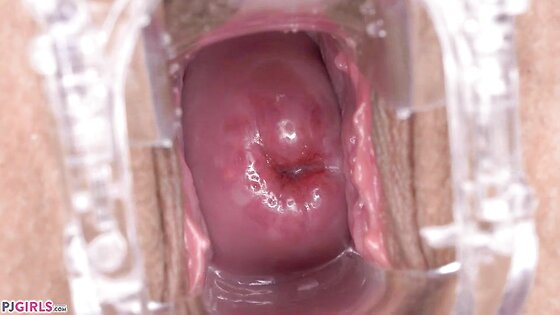 Brunette Slut Masturbates With Speculun Inside