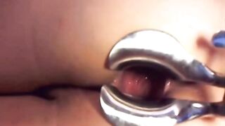 Webcam girl dildo and speculum in asshole by M.D.F 2
