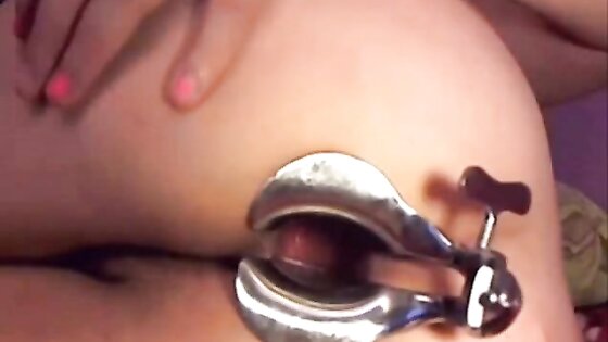 Webcam girl dildo and speculum in asshole by M.D.F 2